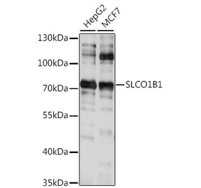 Western Blot - Anti-OATP1B1 Antibody (A91102) - Antibodies.com