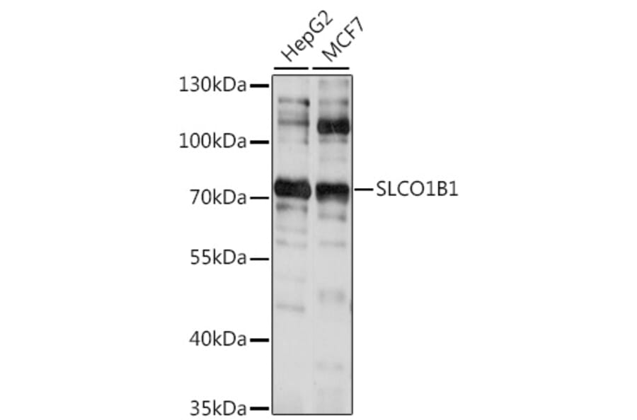 Western Blot - Anti-OATP1B1 Antibody (A91102) - Antibodies.com