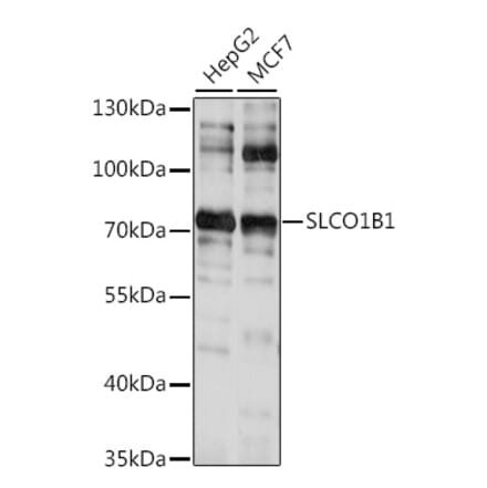 Western Blot - Anti-OATP1B1 Antibody (A91102) - Antibodies.com