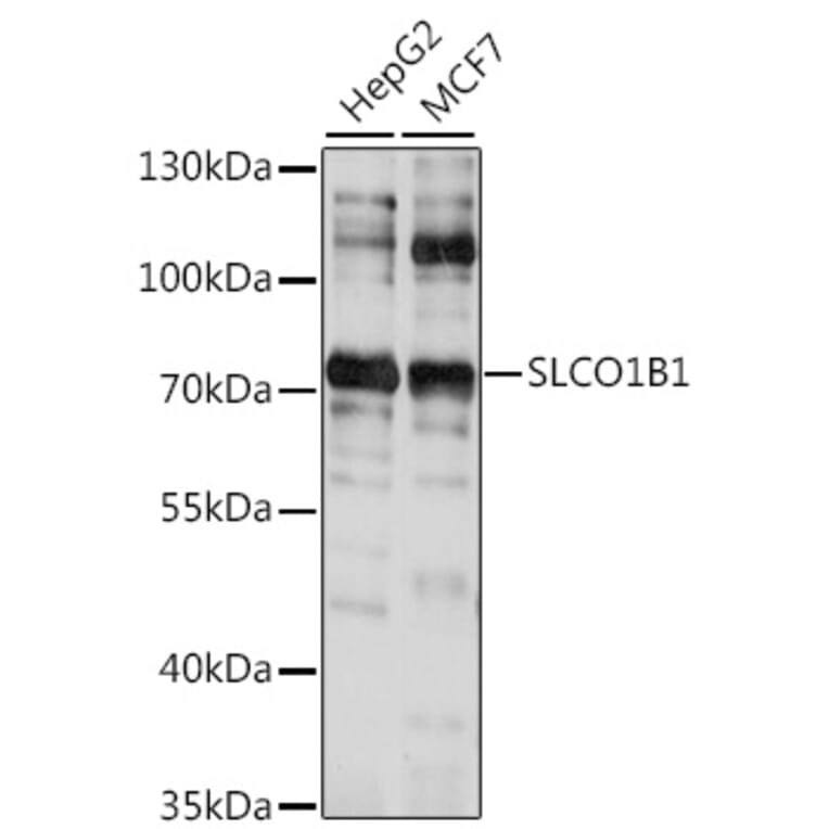 Western Blot - Anti-OATP1B1 Antibody (A91102) - Antibodies.com