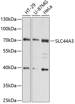 Western blot analysis of extracts of various cell lines, using Anti-SLC44A3 Antibody (A12820) at 1:3000 dilution.
Secondary antibody: Goat Anti-Rabbit IgG (H+L) (HRP) (AS014) at 1:10,000 dilution.
Lysates / proteins: 25µg per lane.
Blocking buffer: 3% non-fat dry milk in TBST.
Detection: ECL Basic Kit (RM00020).
Exposure time: 30s.