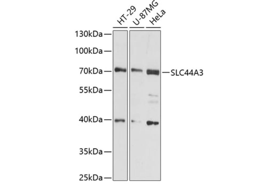 Western Blot - Anti-SLC44A3 Antibody (A91103) - Antibodies.com