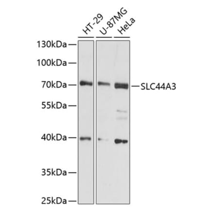 Western Blot - Anti-SLC44A3 Antibody (A91103) - Antibodies.com