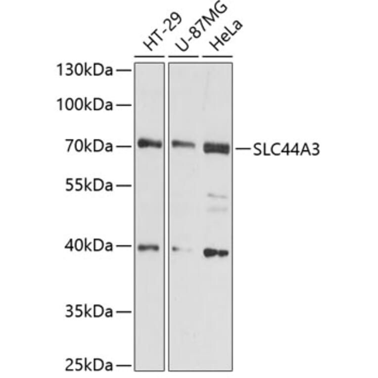 Western Blot - Anti-SLC44A3 Antibody (A91103) - Antibodies.com