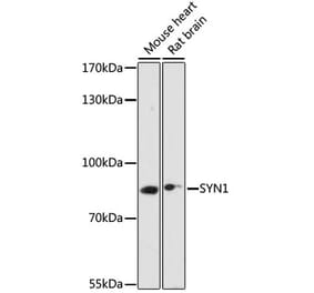 Western Blot - Anti-Synapsin I Antibody (A91104) - Antibodies.com