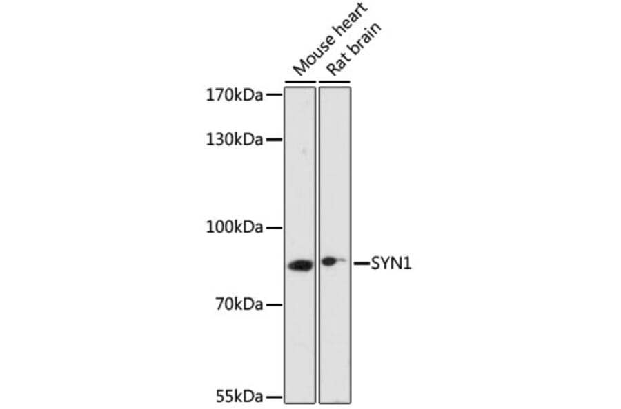 Western Blot - Anti-Synapsin I Antibody (A91104) - Antibodies.com