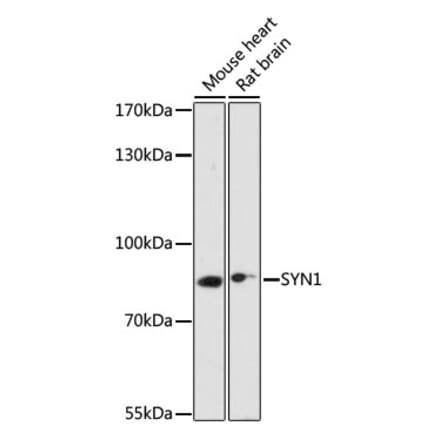 Western Blot - Anti-Synapsin I Antibody (A91104) - Antibodies.com