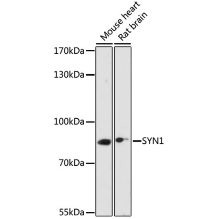 Western Blot - Anti-Synapsin I Antibody (A91104) - Antibodies.com