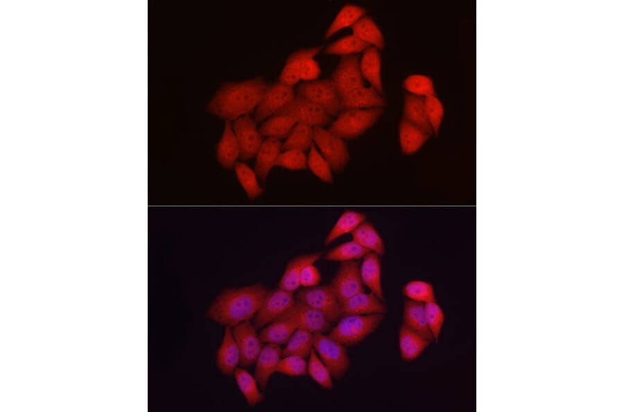 Immunofluorescence - Anti-NUR77 Antibody (A91105) - Antibodies.com