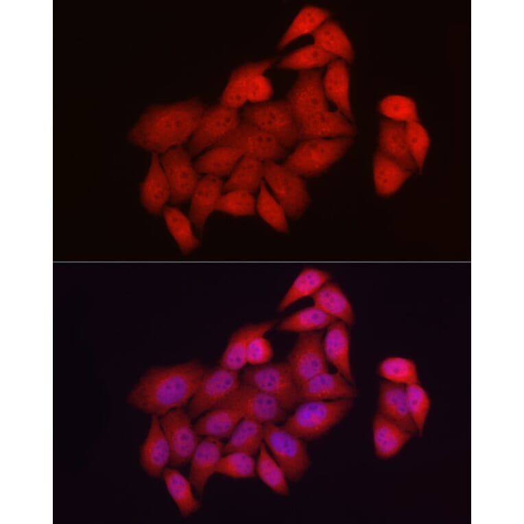 Immunofluorescence - Anti-NUR77 Antibody (A91105) - Antibodies.com