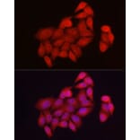 Immunofluorescence - Anti-NUR77 Antibody (A91105) - Antibodies.com