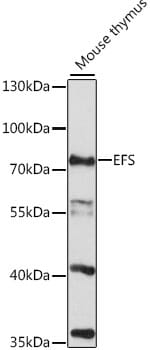 Western blot analysis of extracts of mouse thymus, using Anti-EFS Antibody (A16479) at 1:1,000 dilution.
Secondary antibody: Goat Anti-Rabbit IgG (H+L) (HRP) (AS014) at 1:10,000 dilution.
Lysates / proteins: 25µg per lane.
Blocking buffer: 3% non-fat dry milk in TBST.
Detection: ECL Basic Kit (RM00020).
Exposure time: 90s.