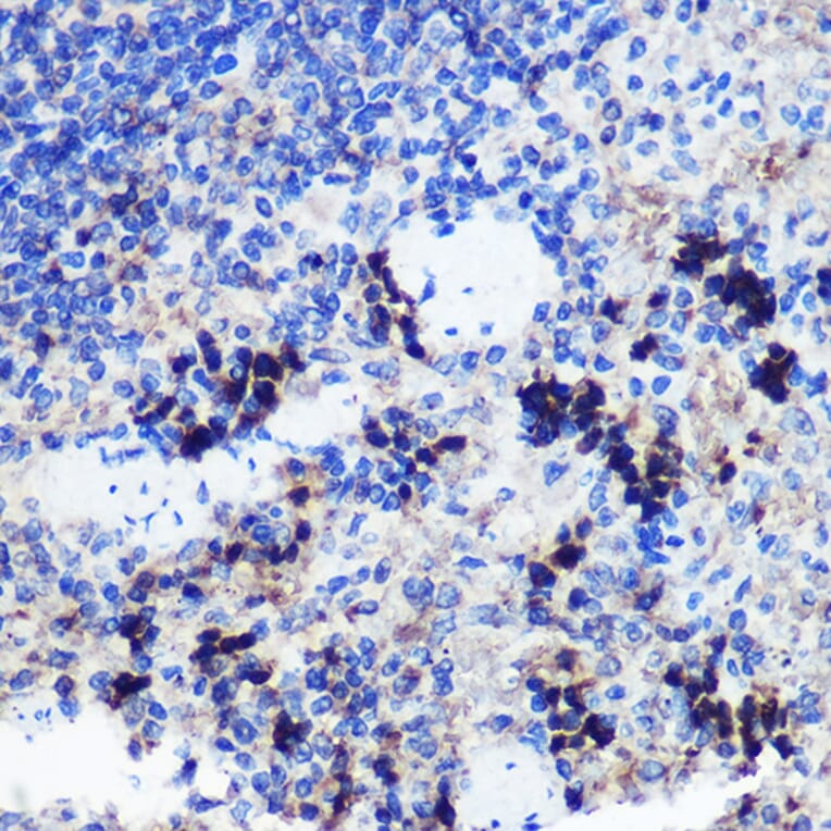 Immunohistochemistry - Anti-FCHSD1 Antibody (A91108) - Antibodies.com