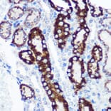 Immunohistochemistry - Anti-FCHSD1 Antibody (A91108) - Antibodies.com