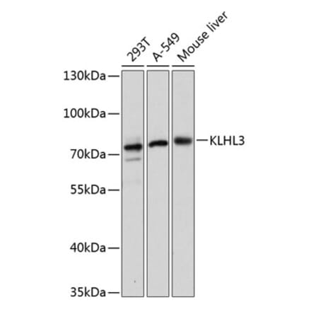 Western Blot - Anti-KLHL3 Antibody (A91109) - Antibodies.com