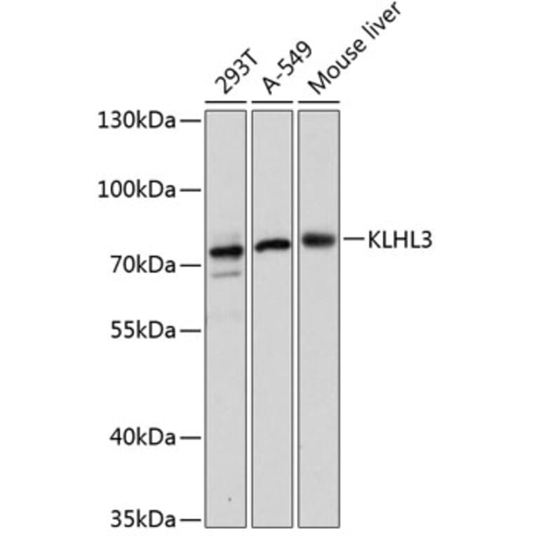 Western Blot - Anti-KLHL3 Antibody (A91109) - Antibodies.com
