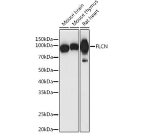 Western Blot - Anti-FLCN Antibody (A91110) - Antibodies.com