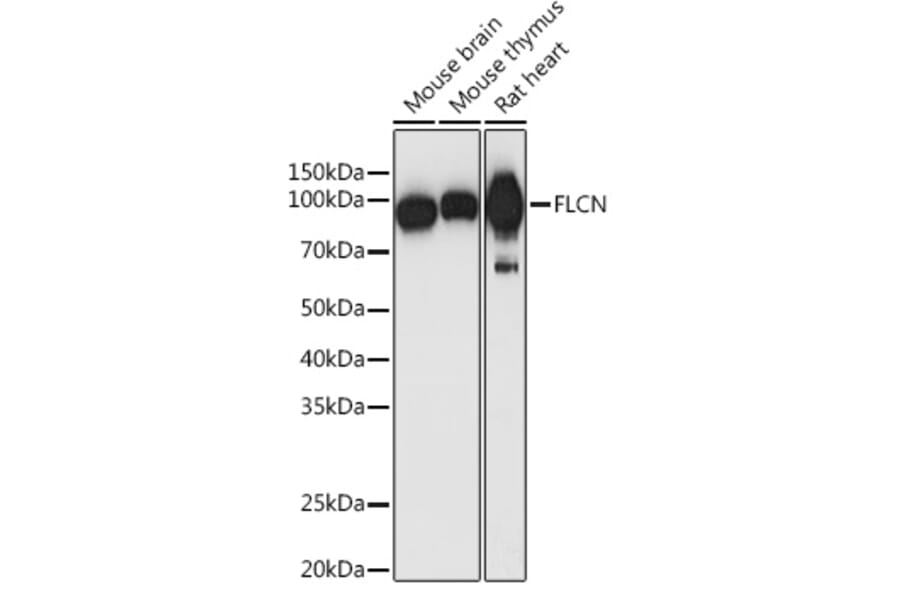 Western Blot - Anti-FLCN Antibody (A91110) - Antibodies.com