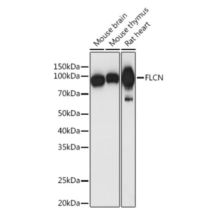 Western Blot - Anti-FLCN Antibody (A91110) - Antibodies.com