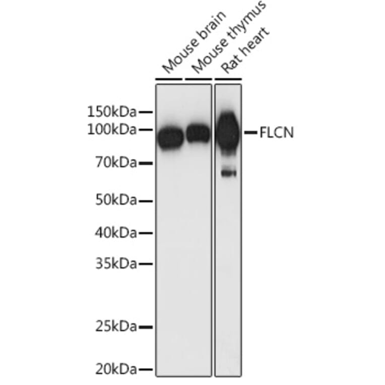 Western Blot - Anti-FLCN Antibody (A91110) - Antibodies.com