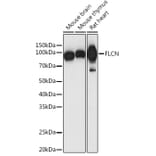 Western Blot - Anti-FLCN Antibody (A91110) - Antibodies.com
