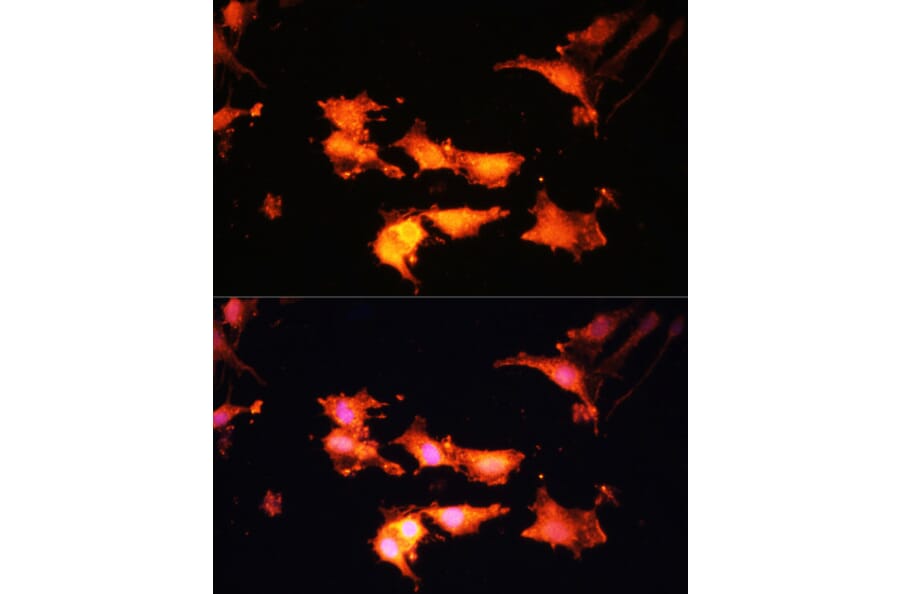 Immunofluorescence - Anti-FLCN Antibody (A91110) - Antibodies.com