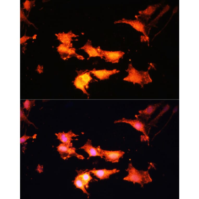 Immunofluorescence - Anti-FLCN Antibody (A91110) - Antibodies.com