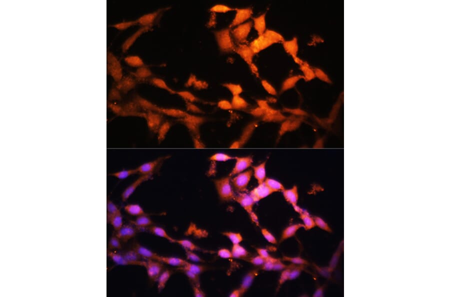 Immunofluorescence - Anti-FLCN Antibody (A91110) - Antibodies.com