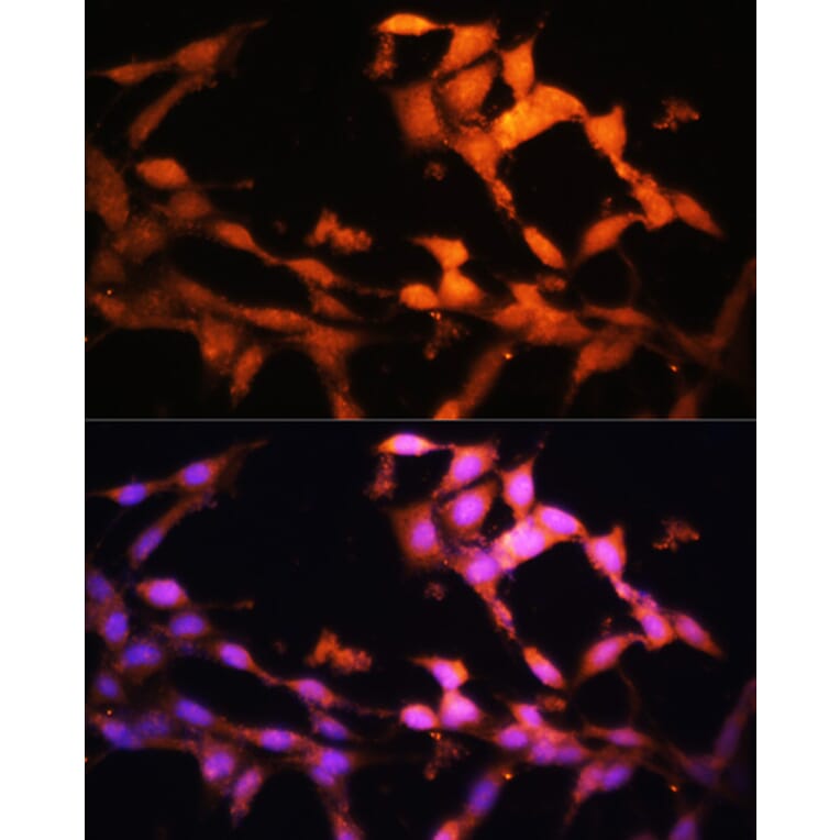 Immunofluorescence - Anti-FLCN Antibody (A91110) - Antibodies.com