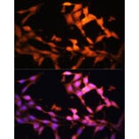 Immunofluorescence - Anti-FLCN Antibody (A91110) - Antibodies.com