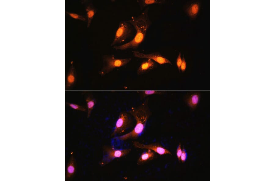 Immunofluorescence - Anti-FLCN Antibody (A91110) - Antibodies.com