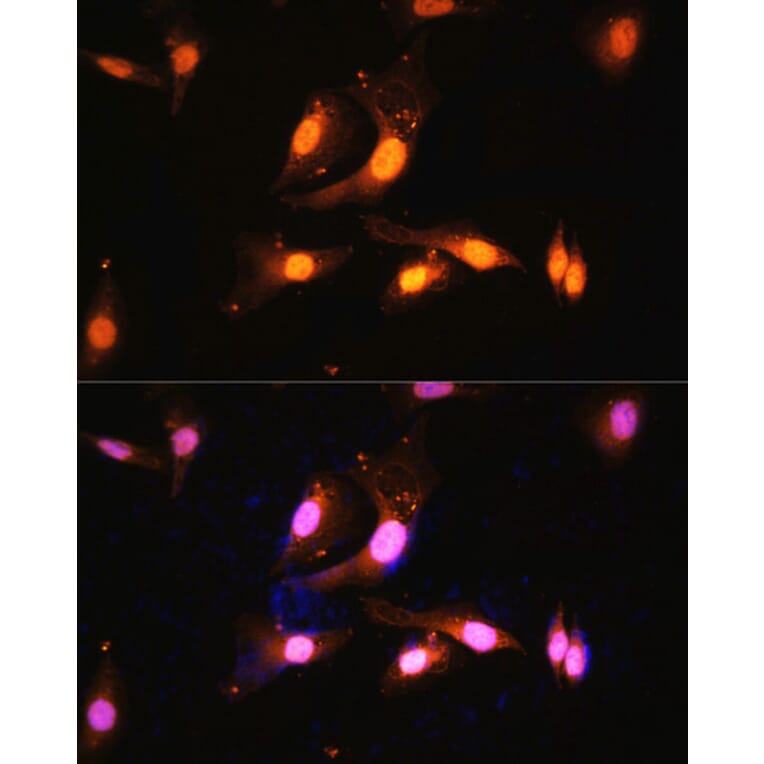 Immunofluorescence - Anti-FLCN Antibody (A91110) - Antibodies.com