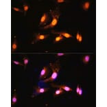 Immunofluorescence - Anti-FLCN Antibody (A91110) - Antibodies.com