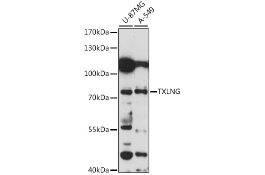 Western Blot - Anti-FIAT Antibody (A91111) - Antibodies.com