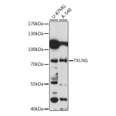Western Blot - Anti-FIAT Antibody (A91111) - Antibodies.com