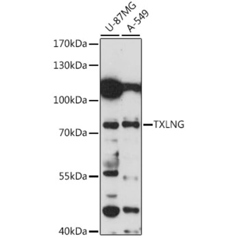 Western Blot - Anti-FIAT Antibody (A91111) - Antibodies.com