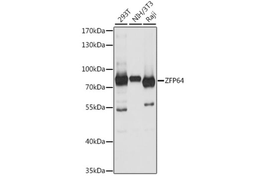 Western Blot - Anti-ZFP64 Antibody (A91112) - Antibodies.com