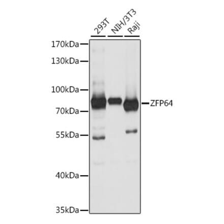 Western Blot - Anti-ZFP64 Antibody (A91112) - Antibodies.com