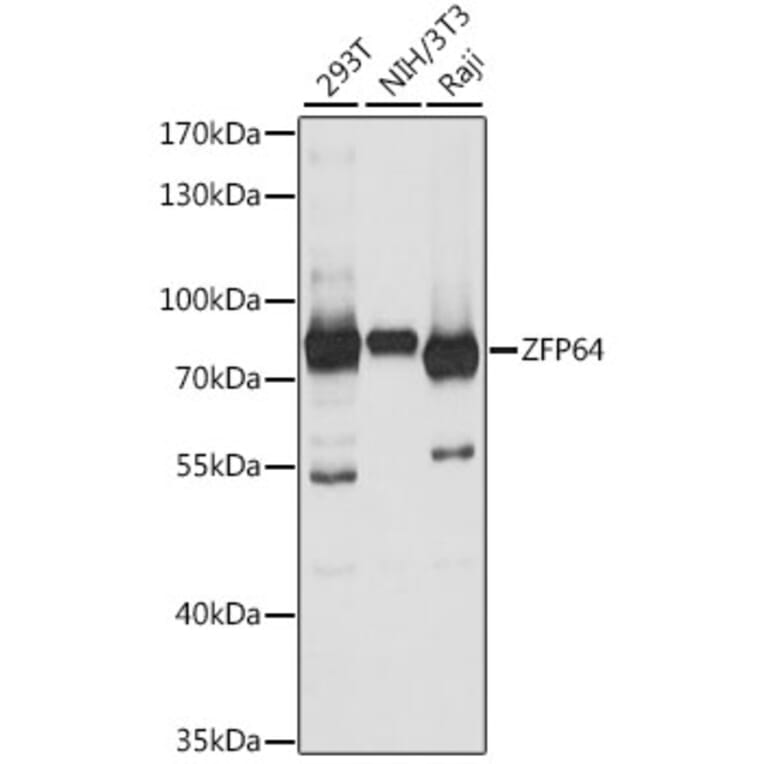 Western Blot - Anti-ZFP64 Antibody (A91112) - Antibodies.com
