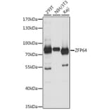 Western Blot - Anti-ZFP64 Antibody (A91112) - Antibodies.com