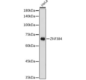 Western Blot - Anti-ZNF384 Antibody (A91113) - Antibodies.com