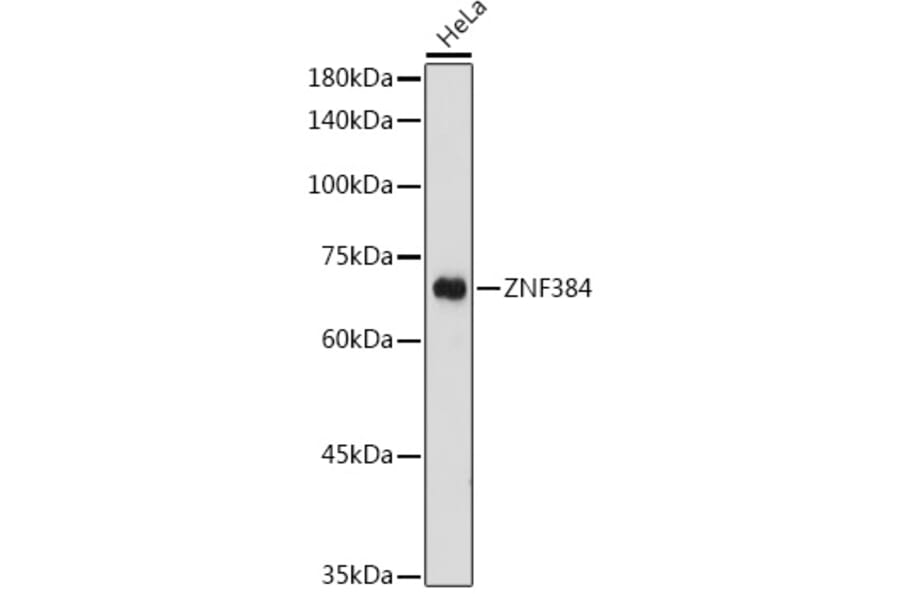 Western Blot - Anti-ZNF384 Antibody (A91113) - Antibodies.com