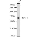 Western Blot - Anti-ZNF384 Antibody (A91113) - Antibodies.com