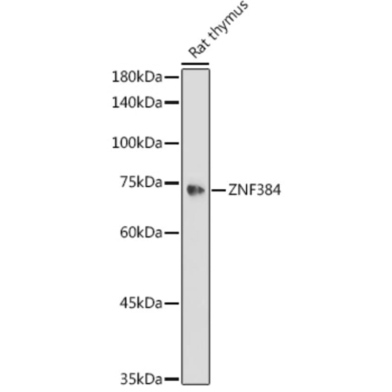 Western Blot - Anti-ZNF384 Antibody (A91113) - Antibodies.com
