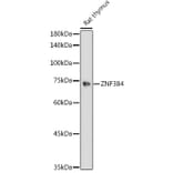 Western Blot - Anti-ZNF384 Antibody (A91113) - Antibodies.com