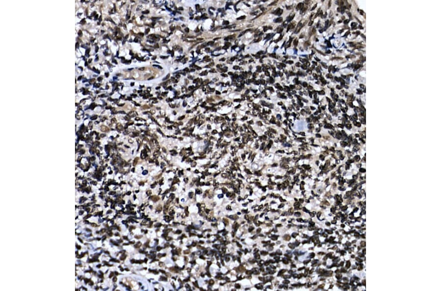 Immunohistochemistry - Anti-ZNF384 Antibody (A91113) - Antibodies.com