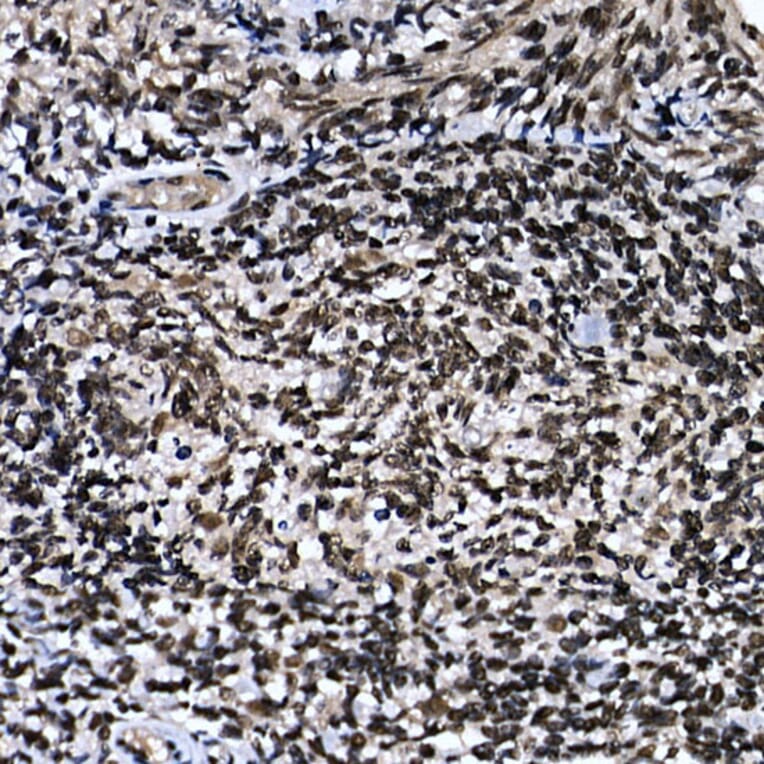 Immunohistochemistry - Anti-ZNF384 Antibody (A91113) - Antibodies.com