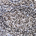 Immunohistochemistry - Anti-ZNF384 Antibody (A91113) - Antibodies.com
