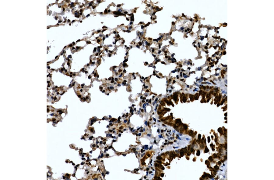 Immunohistochemistry - Anti-ZNF384 Antibody (A91113) - Antibodies.com