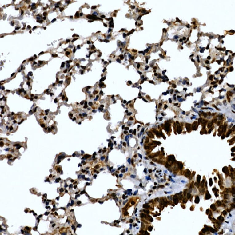 Immunohistochemistry - Anti-ZNF384 Antibody (A91113) - Antibodies.com